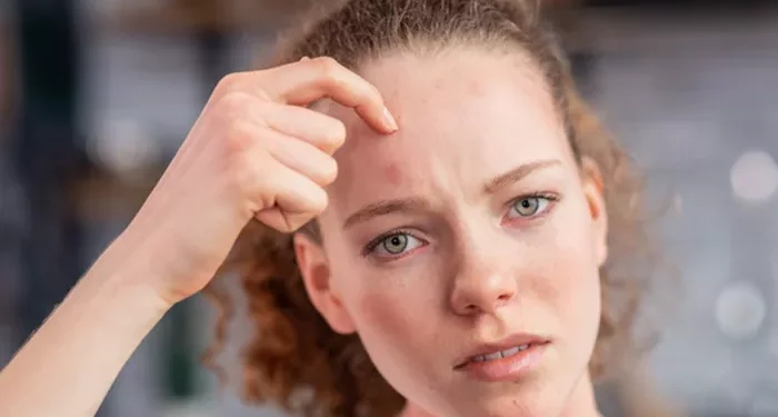 Incorrect Skincare: Things That Cause Your Skin to Deteriorate Quickly